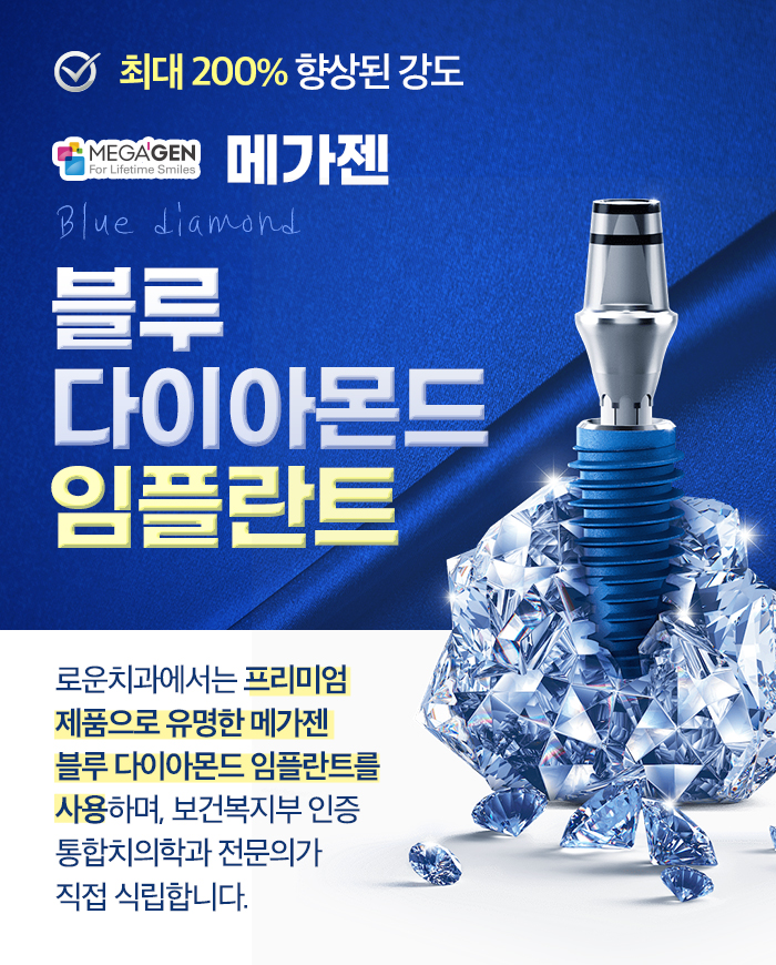 블루 다이아몬드 임플란트