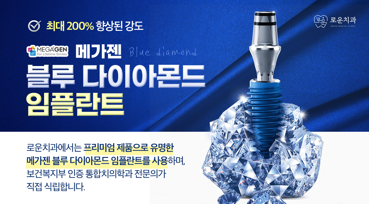블루 다이아몬드 임플란트